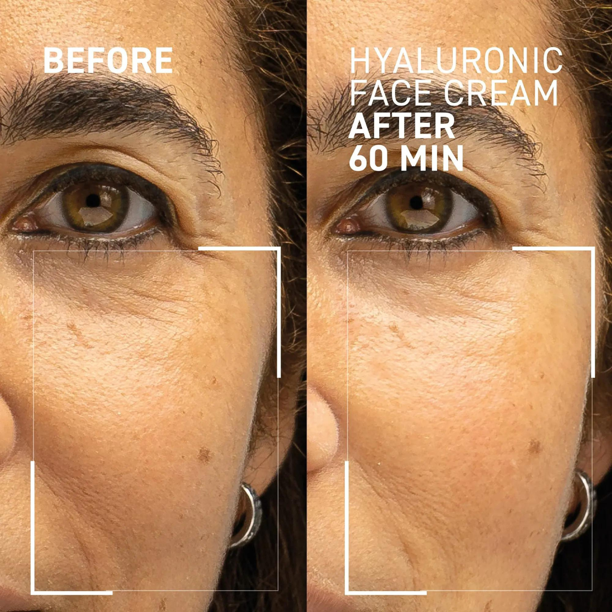 Needles No More - Hyaluronic Face Cream 2.0 (1.7 oz)