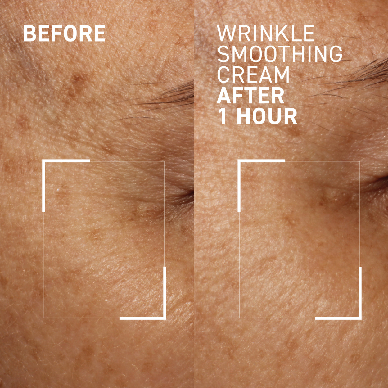 Needles No More - Wrinkle Smoothing Cream (0.5 oz)